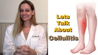 CELLULITIS Everything You Need To Know Symptoms Cause Risk Factors Treatment Prevention [upl. by Sollie]