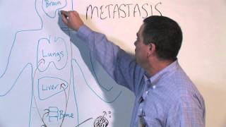 How Cancer Spreads Metastasis  Michael Henry PhD [upl. by Alaik]