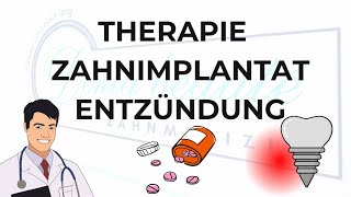 Periimplantitis Therapie  Zahnimplantat Entzündung [upl. by Peale]