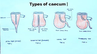 Types of caecum  med tutorials [upl. by Nala]