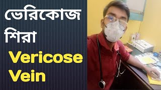 ভেরিকোজ শিরা লক্ষণ এবং চিকিত্সা Vericose Vein [upl. by Cosmo]