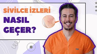 Sivilce İzleri Nasıl Geçer Akne İzleri Tedavisi [upl. by Ninehc569]