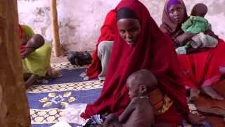 Japan funding assists malnourished Somali children [upl. by Isus970]