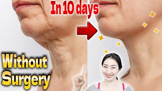 Lift Turkey Neck Without Surgery in 10 days Ultimate Massage for Neck Wrinkles [upl. by Schulz550]