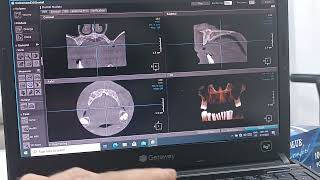 how to read CBCT  شرح طريقة قراءة اشعة ثلاثية الابعاد في طب الاسنان [upl. by Lekim]