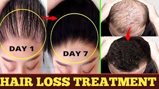 Hair Loss Treatments For Men amp Women According To Science [upl. by Nale]