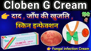 Cloben G Cream Uses in Hindi  Cloben cream use for Fungal infection  Skin disease Cream [upl. by Nosduj]