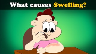 What causes Swelling  more videos  aumsum kids science education children [upl. by Yesmar]