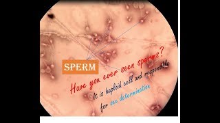 Live Sperm  Sperms under microscope haploid cell  sperm morphology [upl. by Nonac]