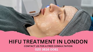 HIFU TREATMENT  SKIN TREATMENT WITH NO DOWN TIME [upl. by Orr86]