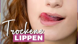 Trockene Lippen Diese Tipps und Hausmittel helfen sofort [upl. by Celene]