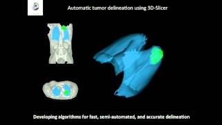 Hugo Aerts plenary talk Radiomics  There is More Than Meets the Eye in Medical Imaging [upl. by Athena943]