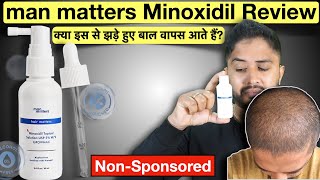 Man Matters Minoxidil for Hair Fall Usage Benefits Side Effects  Complete detailed Review [upl. by Emina]