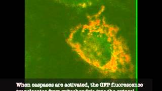 Cells undergoing cell death by apoptosis [upl. by Sucram]