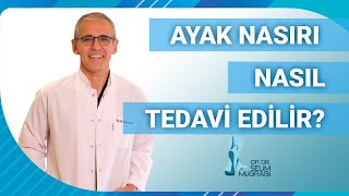 Ayak Nasırı Nasıl Tedavi Edilir [upl. by Nybor]