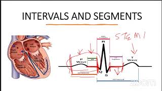 INTRO TO ECG BASICS FOR THE NCLEX [upl. by Llenol]