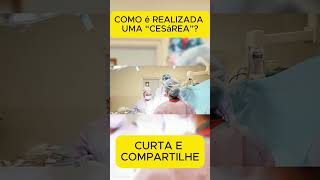 THE DOCTORS GUIDE TO SAFE CESAREA SURGERY curiosidades viralvideo shorts [upl. by Ji]