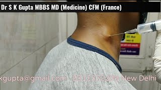 FNAC क्या है कैसे करते है how to do FNAC Fine Needle Aspiration Cytology [upl. by Ellis305]