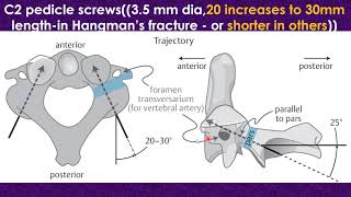 Atlantoaxial subluxation and dislocation [upl. by Anedal]