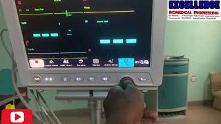 Setting Up different Display pattern for CONMEN 8000E multipara patient monitor [upl. by Eldrid359]