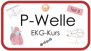 EKG  PWelle Sinusrhythmus SABlock PPulmonale PMitrale PBitrale EKGKurs Teil 3 [upl. by Anaer]