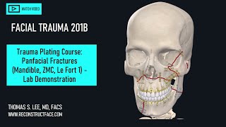 ORIF ZMC Mandible Bilat Le Fort 1 Fx Ex Fix 201B Lab Demo [upl. by Aslin]