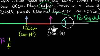 Numerical on hypermetropia [upl. by Jansson]