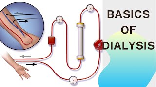 Basic concept of Dialysis Machine  Fresenius 4008S  Dialyzer amp Dialysate Function [upl. by Ymled612]