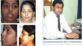 ARPITA SHEULI DASDR ANIRVAN SENGUPTAS PATIENTs INTERVIEW AFTER TREATMENT [upl. by Jaquith]