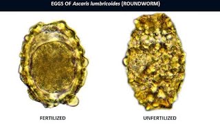 Ascaris lumbricoides overview [upl. by Hilde]