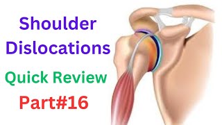 Shoulder dislocations  Anterior dislocation  Posterior dislocation  Inferior dislocation [upl. by Aerdnak]