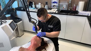 Ablative Erbium Laser for Skin Resurfacing  West Hollywood CA  Dr Jason Emer [upl. by Narak]