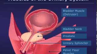 Botox Injections for Bladder Conditions [upl. by Wolk]