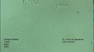 Giardia lamblia intestinalis trophozoite [upl. by Otina]