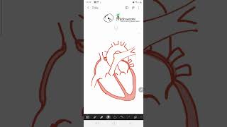 Constrictive Pericarditis mnemonic  ventricular discordance expiratory hepatic vein flow reversal [upl. by Amora]