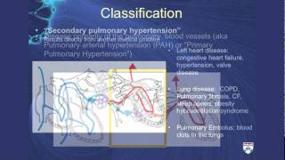 Pulmonary Hypertension A challenging cause of shortness of breath [upl. by Bergeron217]