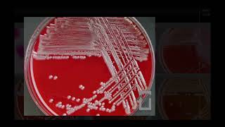 Achromobacter xylosoxidans  Microbiology [upl. by Sam]