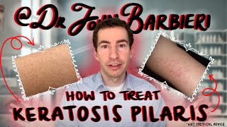 How to treat small pimple bumps on the arms – Dermatologist explains keratosis pilaris [upl. by Lister249]