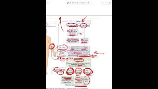 Diabetic Ketoacidosis  Part 4 [upl. by Brodie]