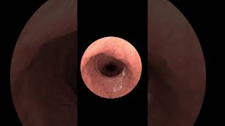 Exploring Your Insides with Gastrointestinal Endoscopy Animation 2024 [upl. by Jadda]