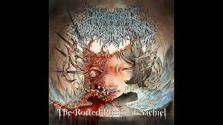 Onchocerciasis Esophagogastroduodenoscopy  The Rotted Plinth of Sachiel Full Album [upl. by Vallery]