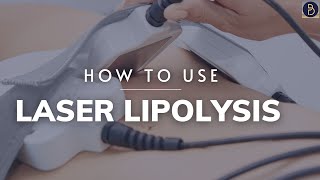 How to use Laser Lipolysis bodysculpting [upl. by Alida160]