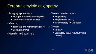 Imaging intracranial hemorrhage  Case 6  Cerebral amyloid angiopathy  CAA [upl. by Weinhardt]