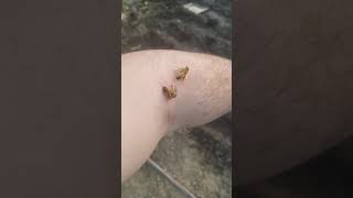 eres alergico a la picadura de abeja mira este video [upl. by Shelbi]