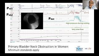 Urinary Bladder Evaluation for Nephrologist ASPN Meeting [upl. by Aihc]