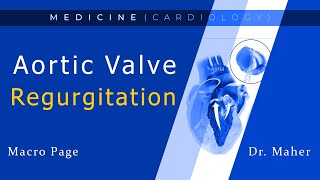 Aortic Regurgitation  With mnemonics   Valvular Heart Disease 3 [upl. by Drahsar]