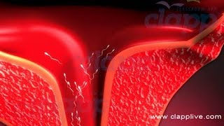 Fertilization in Human  3D Animation [upl. by Obaza246]