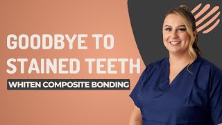 How to whiten composite bonding Can you use Teeth Whitening to whiten [upl. by Aleyam]