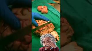 Why Albert Einstein Brain cut into 240 pieces [upl. by Llednav]