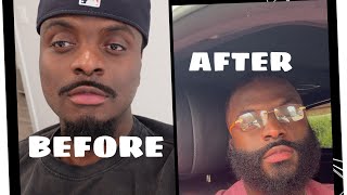 How I Got My Beard to Connect so fast Black Men [upl. by Inoy]